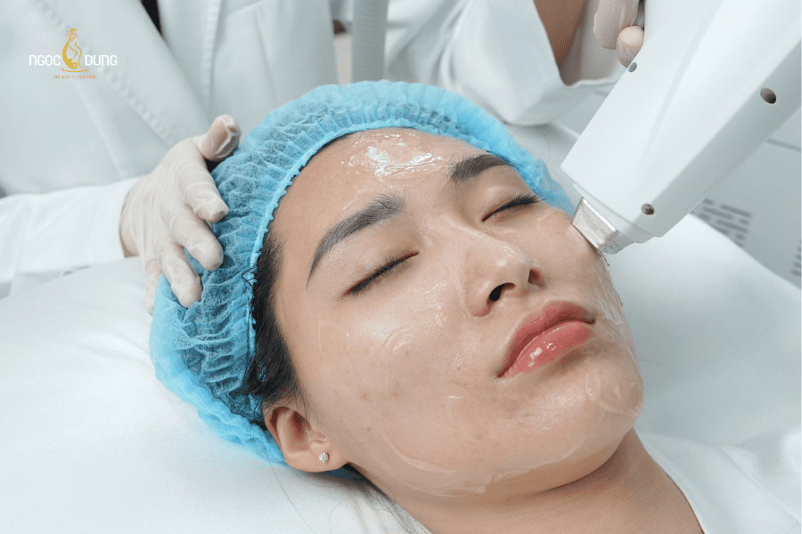 Những ưu điểm khi điều trị thâm mụn bằng công nghệ cao