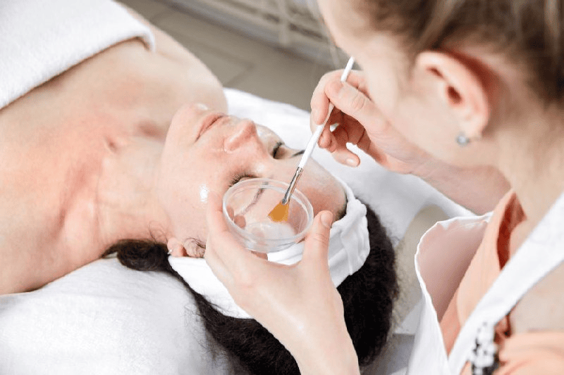 Cách trị sẹo mụn và phòng tránh sẹo sau mụn giúp da láng mịn 6 Peel da hóa học giúp tái tạo làn da mới mịn màng, sáng khỏe hơn