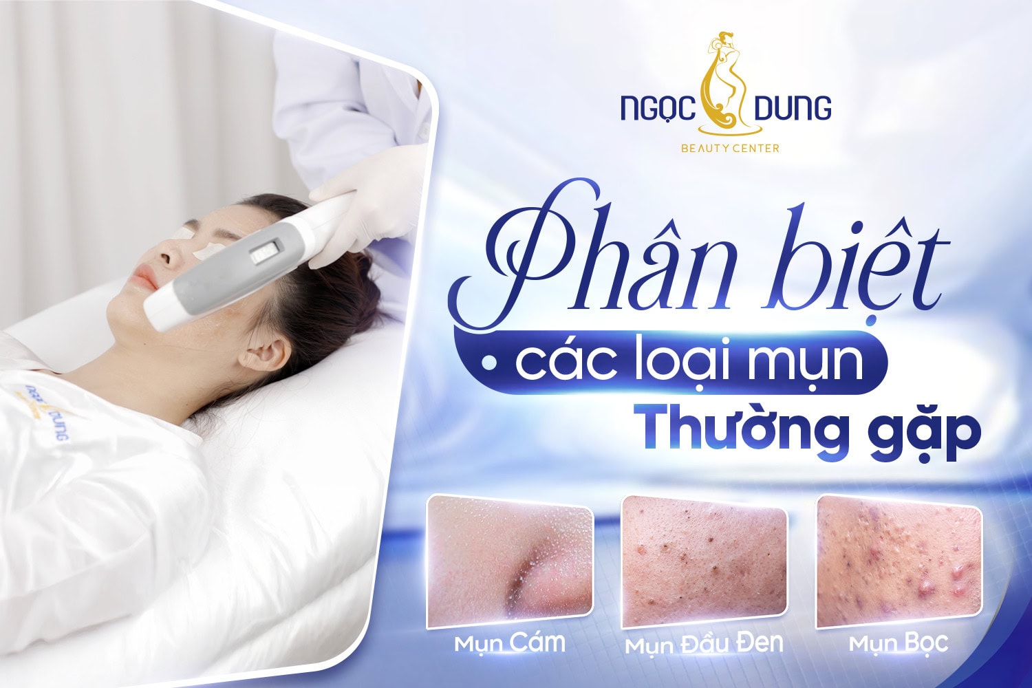 Mặt mụn khiến khuôn mặt “kém xinh” và thiếu sức sống, mách bạn cách phân loại mụn cực đơn giản phân biệt các loại mụn