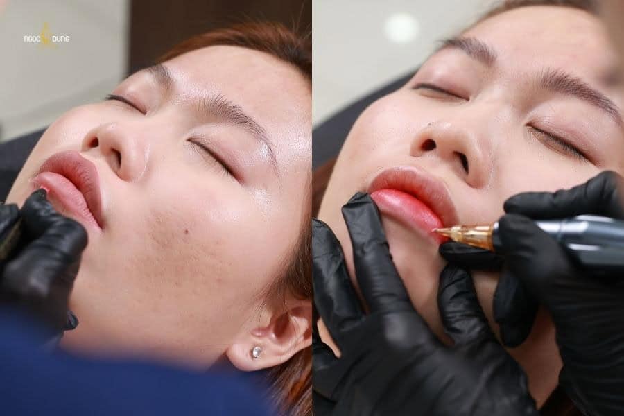 Cách dưỡng môi sau phun xăm lên màu chuẩn đẹp, lâu bền 8 Hãy đến Ngọc Dung để có kết quả phun môi như ý, màu chuẩn và bền lâu