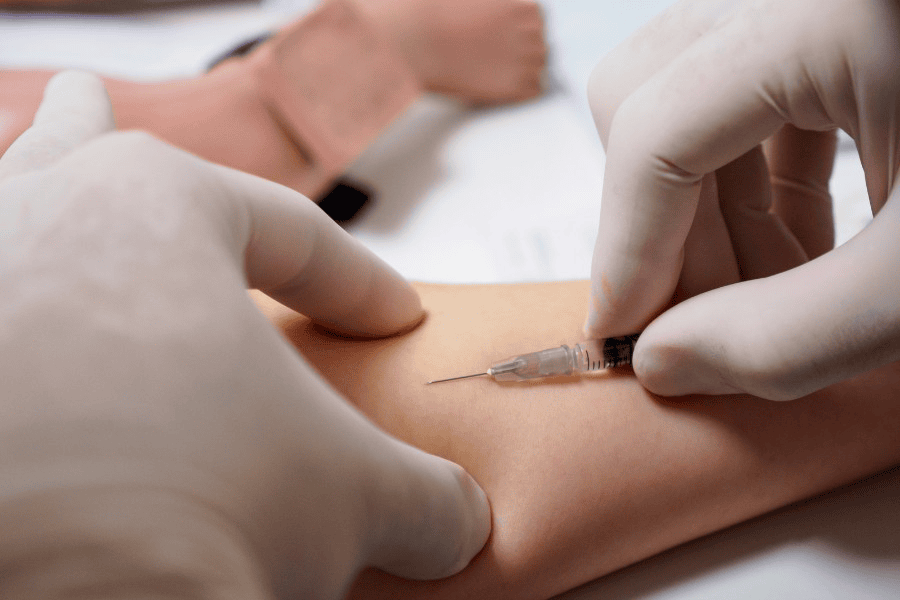 Cách điều trị sẹo phì đại an toàn, hiệu quả và thẩm mỹ 3 Phương pháp nội khoa tiêm Corticoid hiệu quả với những sẹo có tuổi đời dưới 2 năm