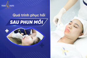 Quá trình phục hồi sau phun môi và lưu ý để môi nhanh lên màu