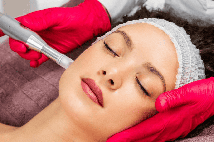 Quy trình lăn kim trị thâm mụn tại các spa uy tín