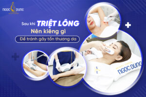 sau khi triet long nen kieng gi