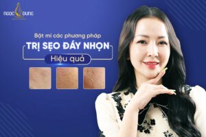 Sẹo đáy nhọn là gì? Sẹo đáy nhọn có chữa được không?