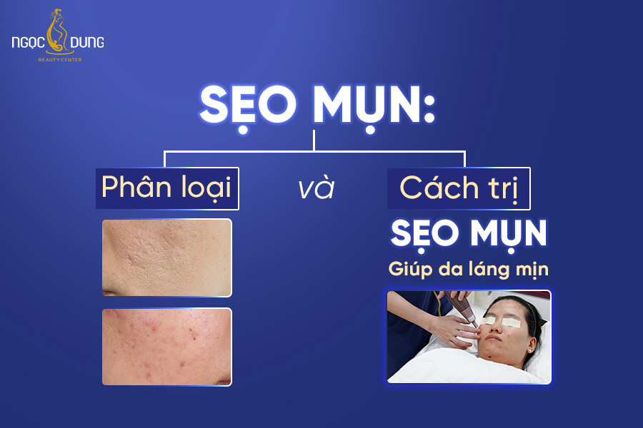 Tham khảo ngay cách phân loại và trị sẹo mụn giúp da láng mịn Tham khảo ngay cách phân loại và trị sẹo mụn giúp da láng mịn