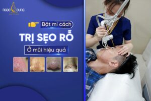 Sẹo rỗ ở mũi là gì