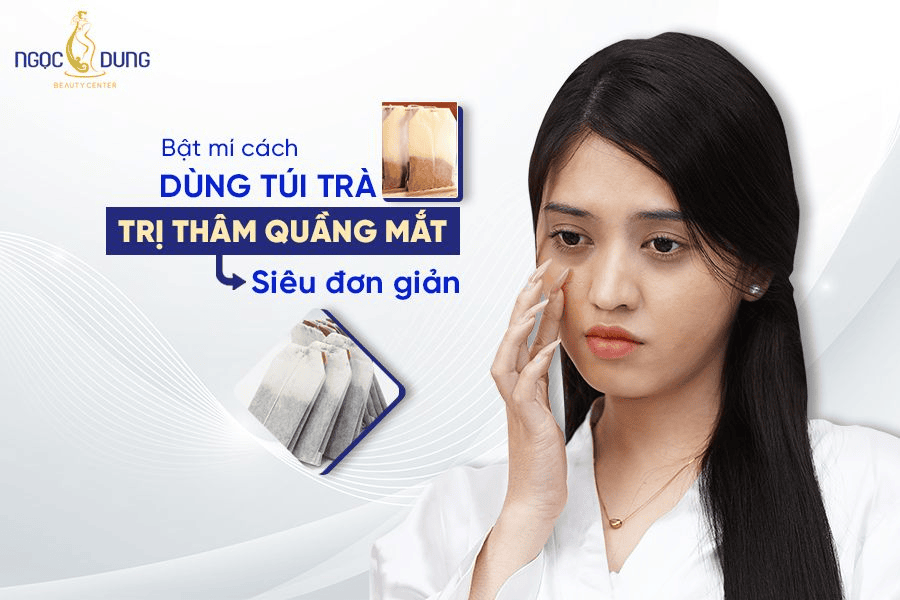 Sử dụng túi trà trị quầng thâm mắt 