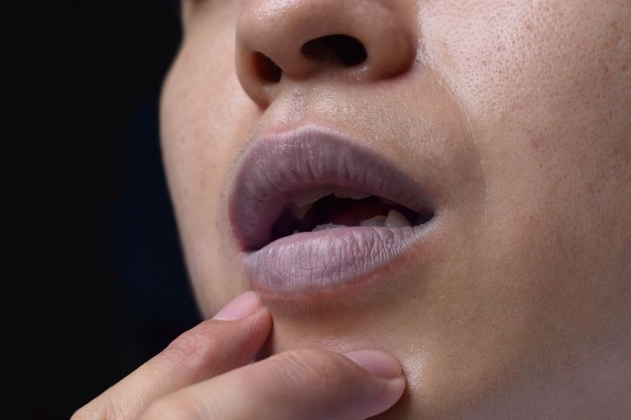 Xác định đúng tình trạng môi thâm là bước quan trọng để lựa chọn giải pháp cải thiện an toàn và hiệu quả