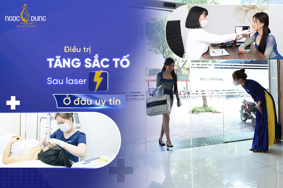 Tăng sắc tố sau laser có tự hết không? Cách điều trị hiệu quả 10 Tăng sắc tố sau laser là gì? Điều trị tăng sắc tố sau laser ở đâu uy tín?