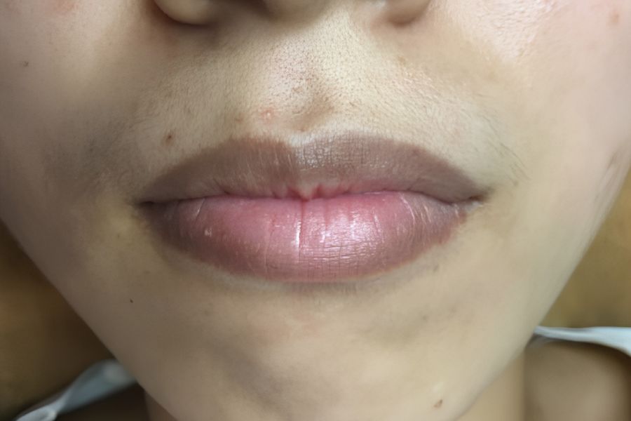 Màu môi nâu đậm hoặc xám có thể liên quan đến sắc tố tự nhiên, kích ứng hoặc một số vấn đề sức khỏe