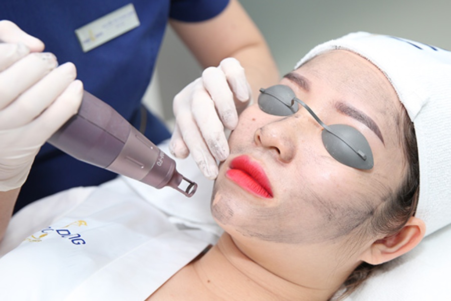 Kỹ thuật viên đang thực hiện trẻ hóa da mặt bằng laser cho khách hàng