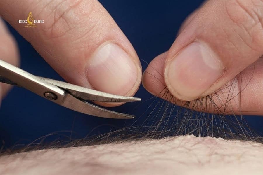 Nên cắt tỉa lông gọn gàng trước khi tiến hành cạo lông vùng kín nữ