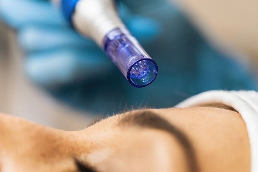 Hãy đến các cơ sở thẩm mỹ uy tín để được dịch vụ lăn kim an toàn và uy tín