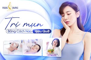 điều trị mụn