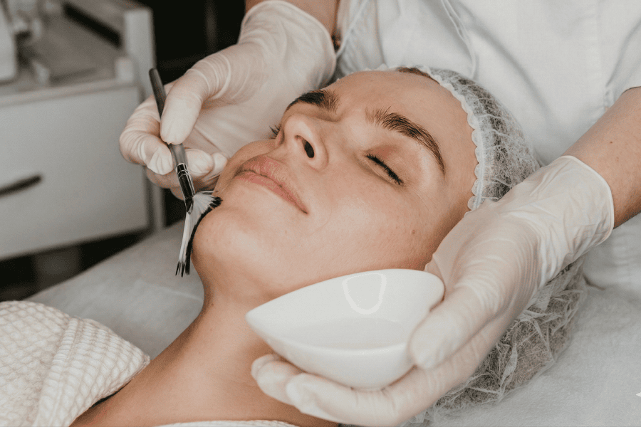 Bạn có thể peel da tại các cơ sở uy tín để trị mụn mọc quanh miệng