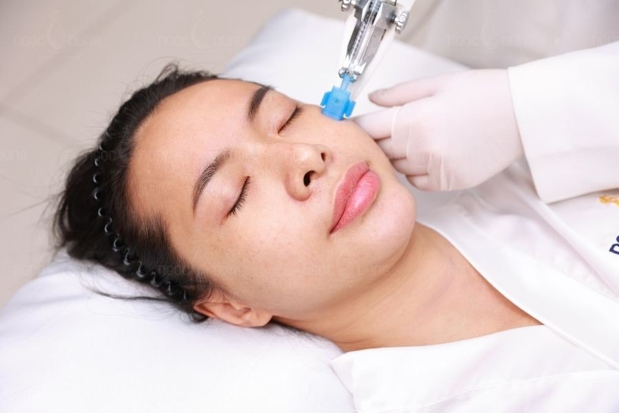 Ngọc Dung mang đến liệu trình trị tăng sắc tố sau viêm chuẩn chỉn và chuyên nghiệp