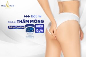 Trị thâm mông bằng vaseline