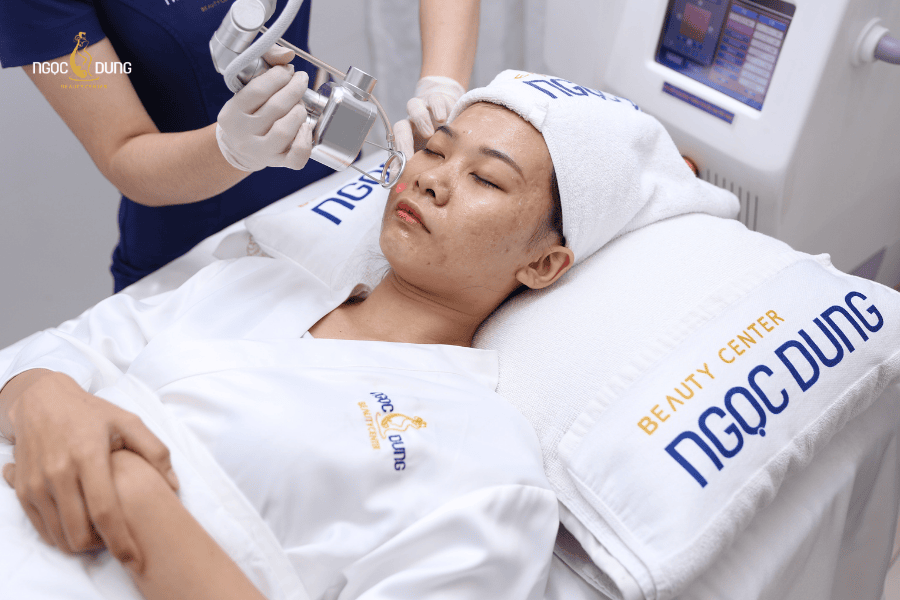 Trị thâm mụn bằng Fractional CO2 tại TMV Ngọc Dung có hiệu quả không? 