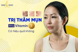 Chuyên gia giải đáp: Trị thâm mụn bằng vitamin e có hiệu quả không?