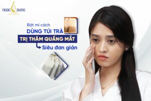 Túi trà trị thâm quầng mắt