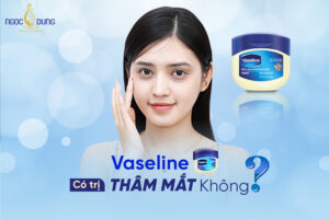 Tìm hiểu về Vaseline có trị thâm mắt không?