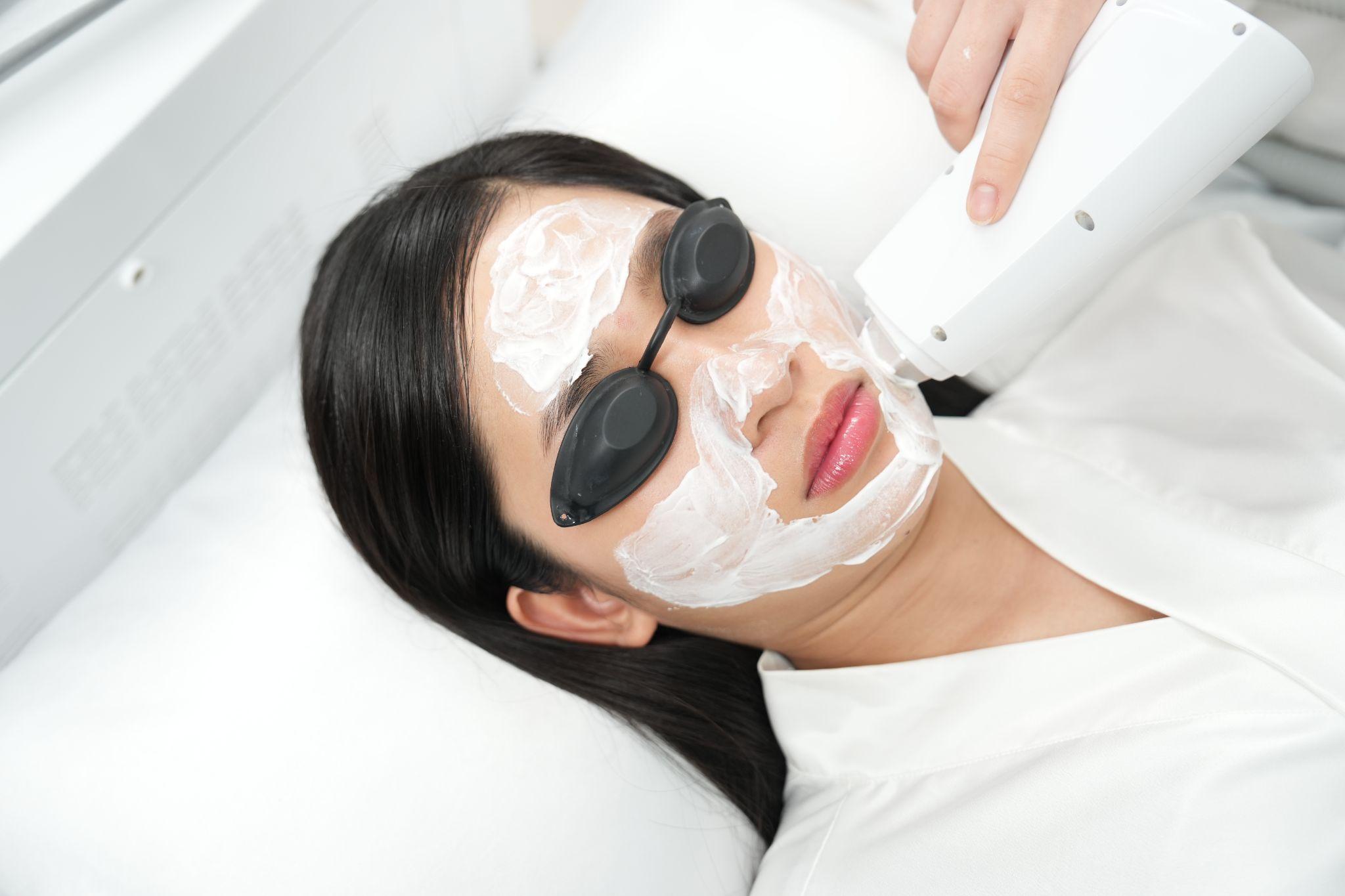 Vệ sinh da giúp loại bỏ bã nhờn và bôi tê để chuẩn bị cho quá trình trị sẹo bằng laser