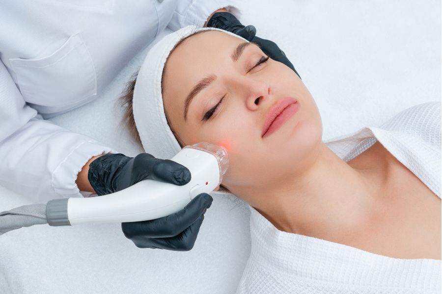 Xóa vết thâm mụn bằng laser được thực hiện nhanh chóng, không đau, không cần nghỉ dưỡng Xóa vết thâm mụn bằng laser được thực hiện nhanh chóng, không đau, không cần nghỉ dưỡng
