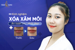 Xăm môi xong có xóa được không? Bật mí kinh nghiệm xóa xăm môi hỏng cho chị em.