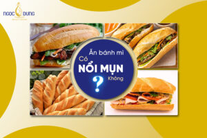 Ăn bánh mì có nổi mụn không? Cách ăn bánh mì không nổi mụn