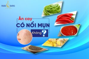 Ăn cay có nổi mụn không? Bí quyết ăn cay không bị nổi mụn