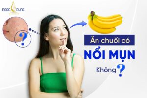 Giải đáp từ chuyên gia: ăn chuối có nổi mụn không? 