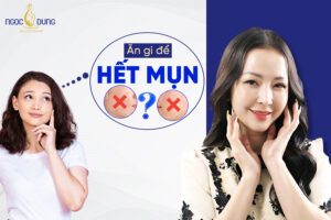 Ăn gì để hết mụn? Top 11 loại thực phẩm dành cho da mụn