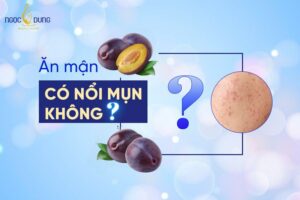 Giải đáp cùng chuyên gia thẩm mỹ: Ăn mận có nổi mụn không?