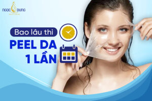 Bao lâu thì peel da 1 lần