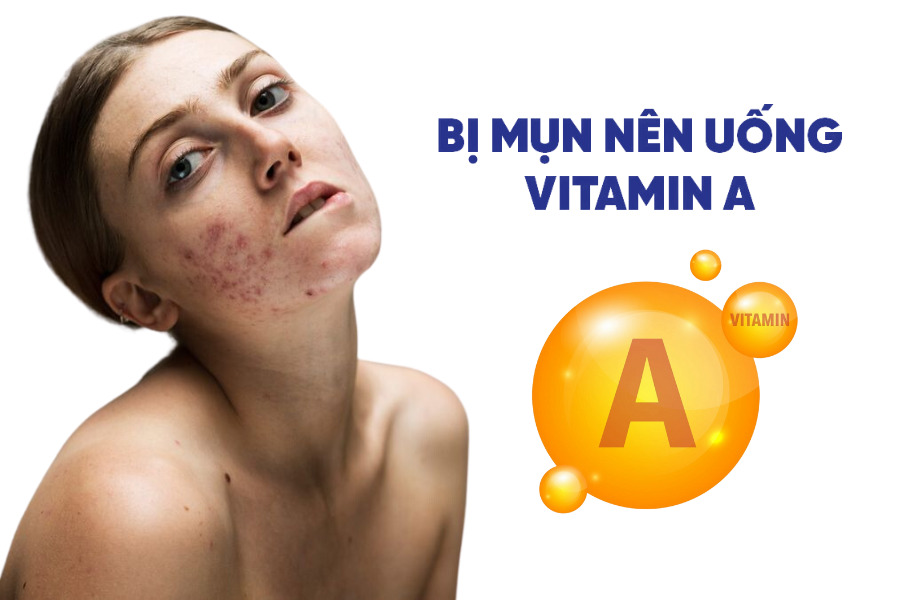 Vitamin A có khả năng điều tiết lượng dầu nhờn giúp làm sạch lỗ chân lông