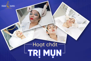 Top 10 các hoạt chất trị mụn được chuyên gia da liễu tin dùng