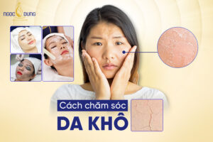 cách chăm sóc da khô