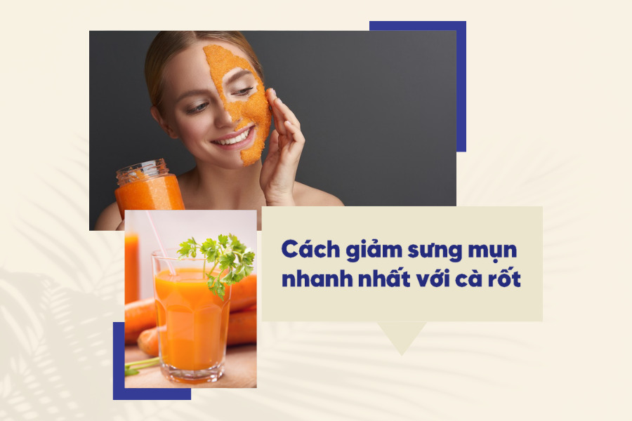 Cách trị mụn sưng viêm bằng cà rốt cực đơn giản