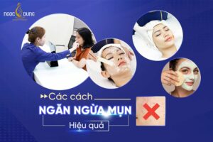 Tổng hợp các cách ngăn ngừa mụn hiệu quả cho chị em