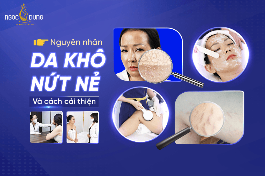 Cách trị da khô nứt nẻ hiệu quả tại nhà và công nghệ cao 