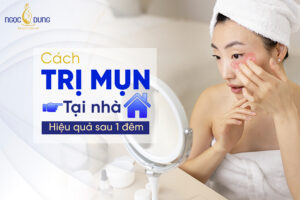 Tổng hợp 27 cách trị mụn tại nhà hiệu quả sau 1 đêm