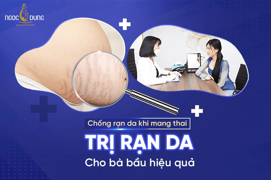 Cách trị rạn da cho bà bầu an toàn, hiệu quả giúp mẹ lấy lại làn da mịn màng 