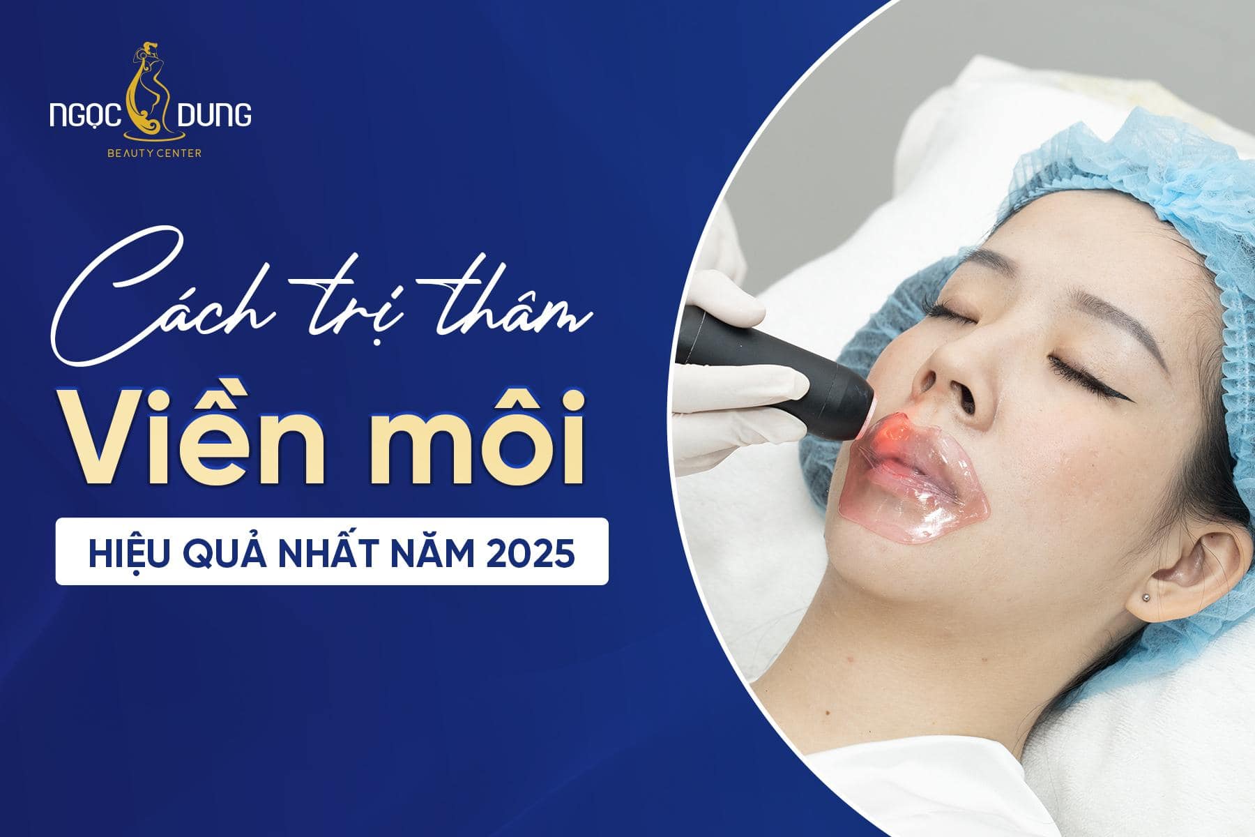 Cách trị thâm viền môi hiệu quả nhất năm 2026
