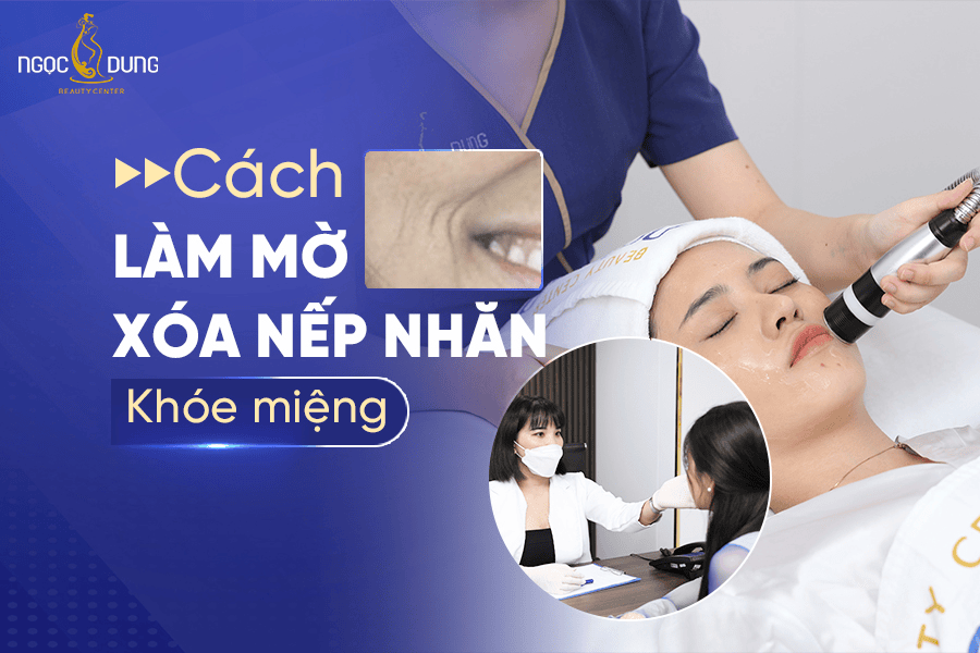 Cách xóa nếp nhăn khóe miệng giúp trẻ hóa gương mặt nhanh chóng 