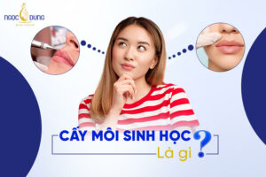 Cấy môi sinh học là gì? Ưu - nhược điểm và lưu ý khi cấy môi