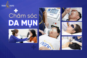 8 bước chăm sóc da mụn, giúp da mịn màng, sạch mụn