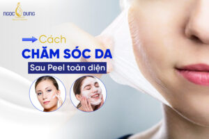 chăm sóc da sau peel