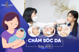 chăm sóc da sau sinh