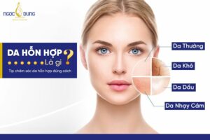 Da hỗn hợp là gì? Cùng chuyên gia giải đáp ngay